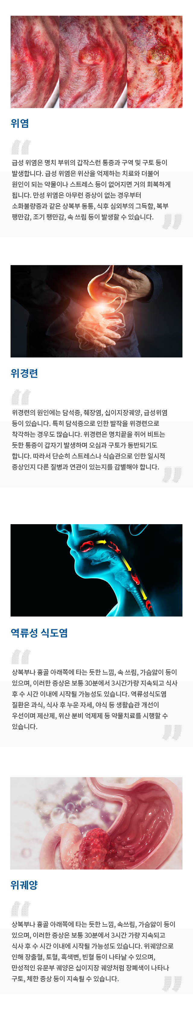 소화기내과